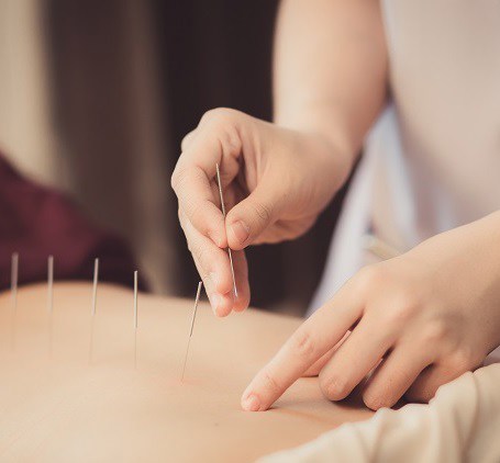 Medicina Tradicional Chinesa